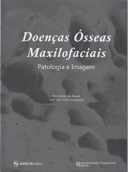 Imagem de Doenças Ósseas Maxilofaciais