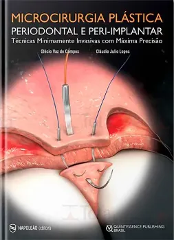 Picture of Book Microcirurgia Plástica Periodontal e Peri-Implantar