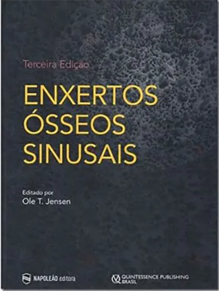 Imagem de Enxertos Ósseos Sinusais