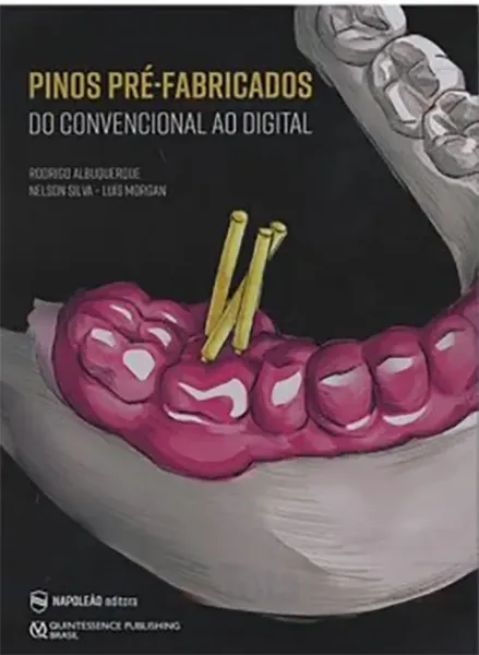Imagem de Pinos Pré-Fabricados do Convencional ao Digital