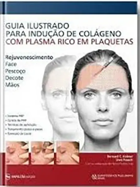 Imagem de Guia Ilustrado para Indução de Colágeno com Plasma Rico em Plaquetas