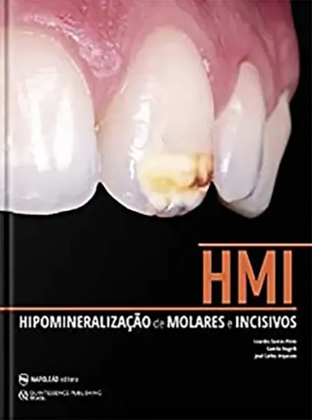 Imagem de Hipomineralização de Molares e Incisivos