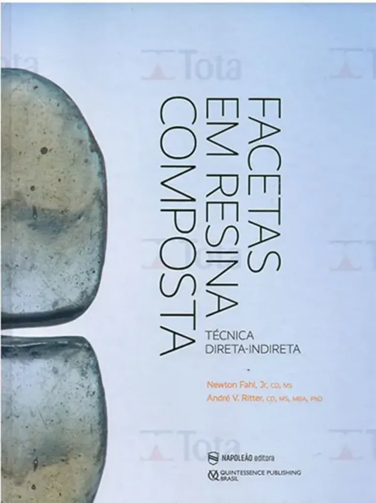 Imagem de Facetas em Resina Composta: Técnica Direta-Indireta