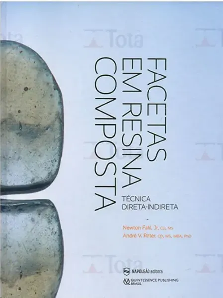 Imagem de Facetas em Resina Composta: Técnica Direta-Indireta