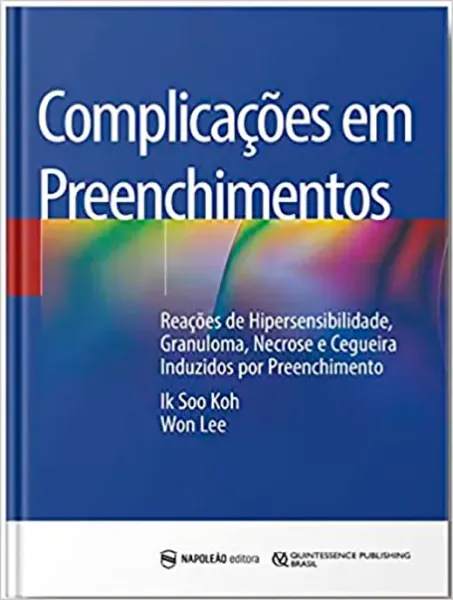 Imagem de Complicações em Preenchimentos