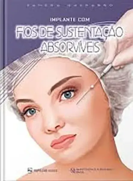 Imagem de Implante de Fios de Sustentação Absorvíveis