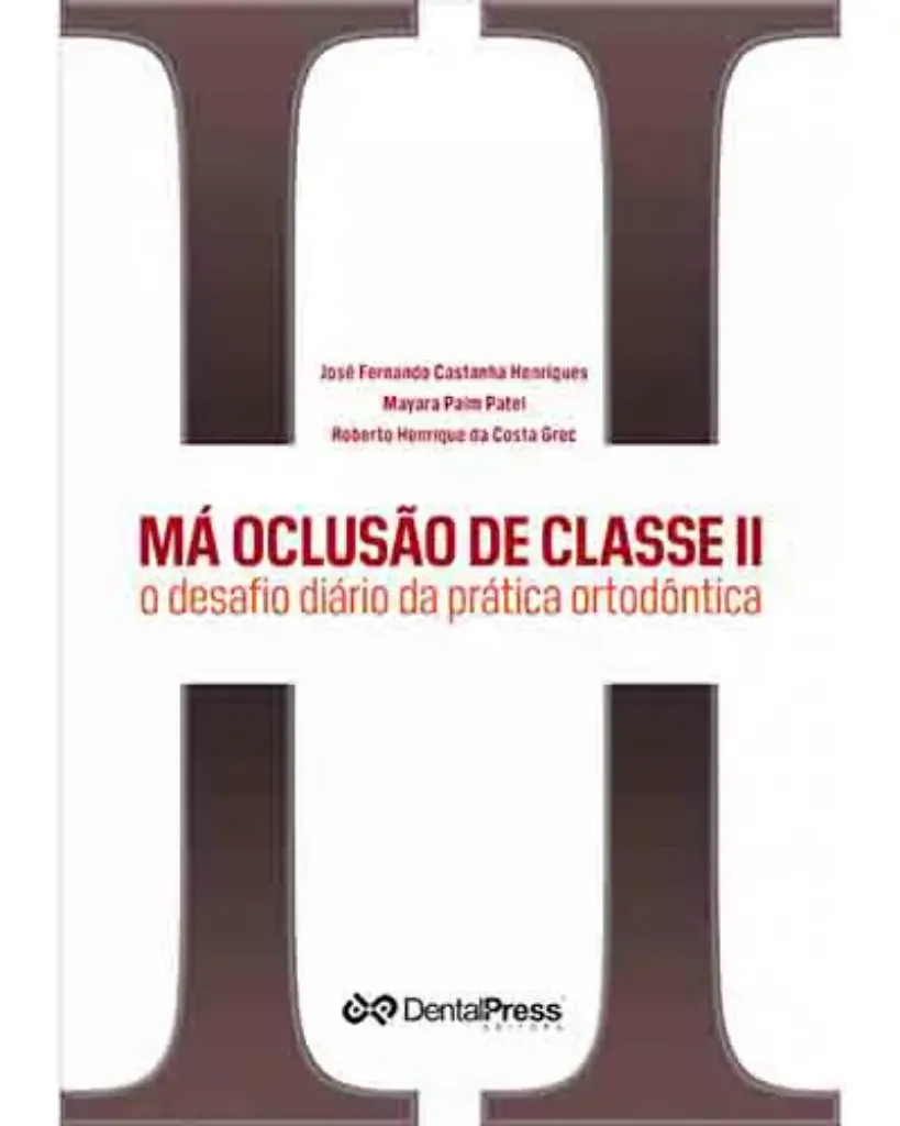 Imagem de Má Oclusão de Classe II: O Desafio Diário da Prática Ortodôntica