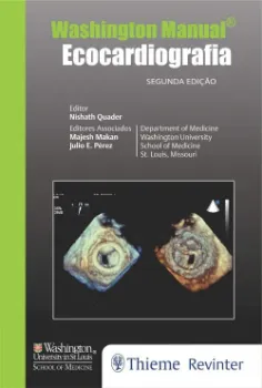 Picture of Book Washington Manual - Ecocardiografia