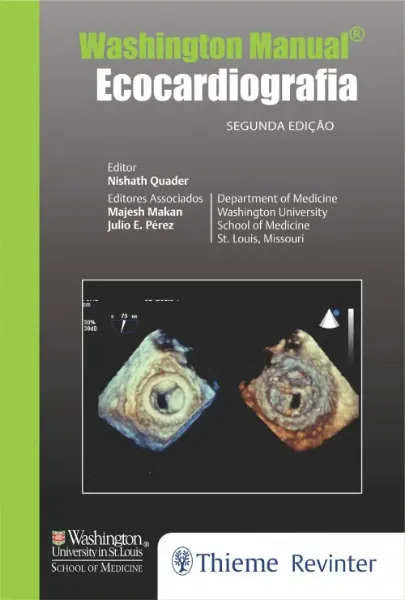 Imagem de Washington Manual - Ecocardiografia