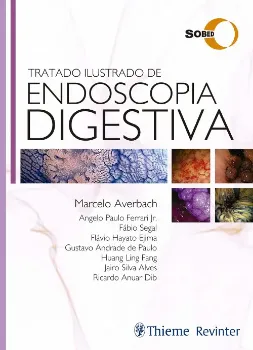 Picture of Book Tratado Ilustrado de Endoscopia Digestiva