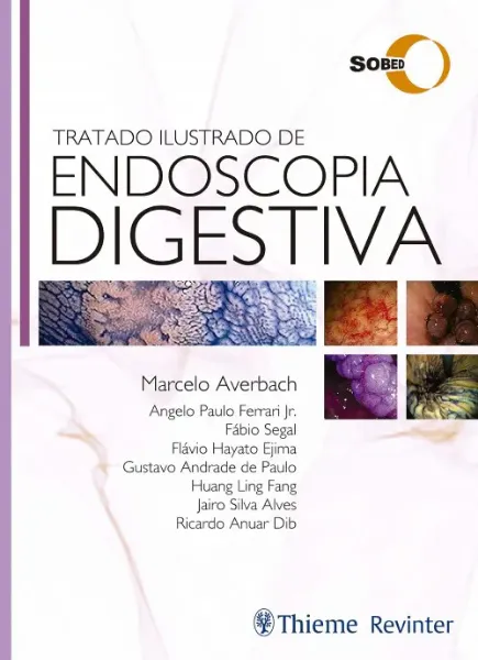 Imagem de Tratado Ilustrado de Endoscopia Digestiva