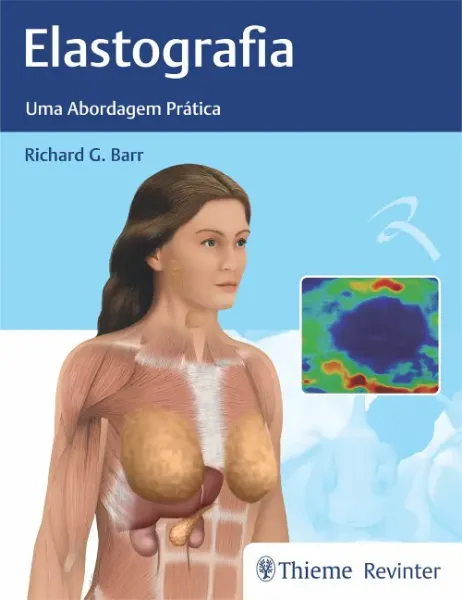 Imagem de Elastografia