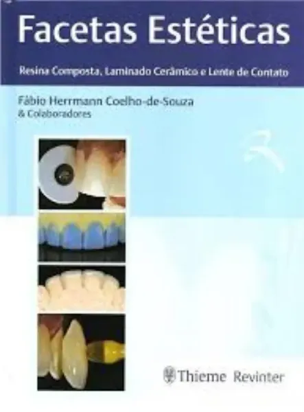 Imagem de Facetas Estéticas - Resina Composta, Laminado Cerâmico e Lente de Contato