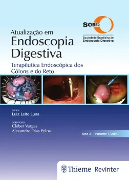 Picture of Book Atualização em Endoscopia Digestiva - Terapêutica Endoscópica dos Cólons e do Reto