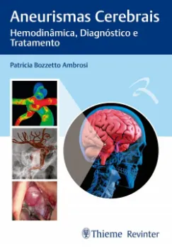 Picture of Book Aneurismas Cerebrais - Hemodinâmica, Diagnóstico e Tratamento