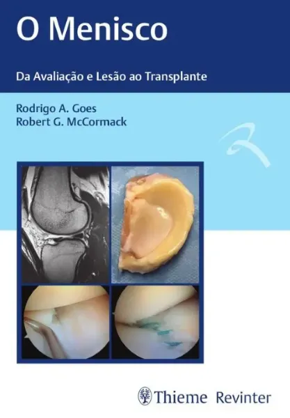 Imagem de O Menisco - Da Avaliação e Lesão ao Transplante