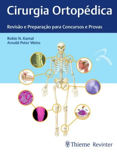 Imagem de Cirurgia Ortopédica - Revisão e Preparação para Concursos e Provas