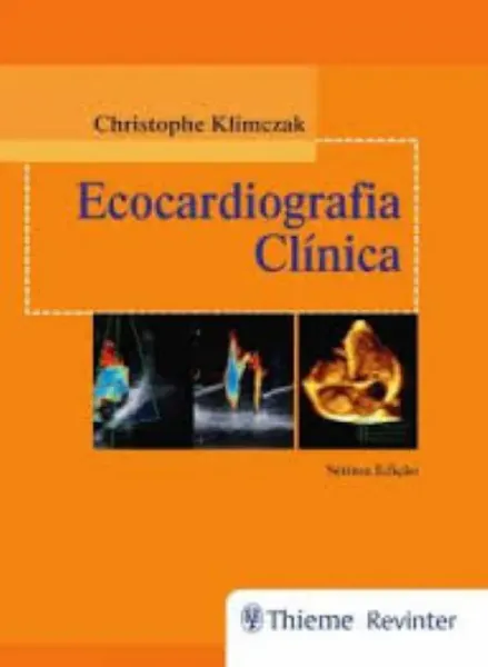 Imagem de Ecocardiografia Clínica
