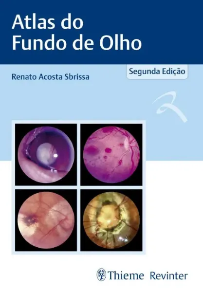 Imagem de Atlas do Fundo de Olho