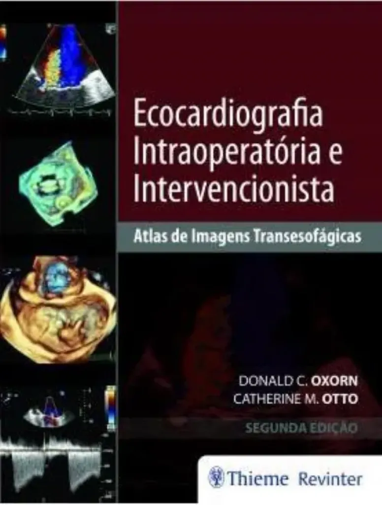 Imagem de Ecocardiografia Intraoperatória e Intervencionista - Atlas de Imagens Transesofágicas
