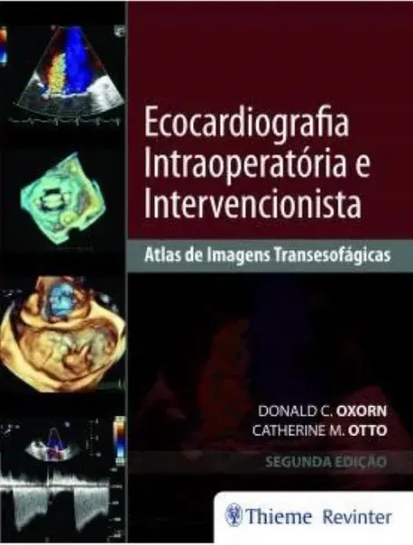 Imagem de Ecocardiografia Intraoperatória e Intervencionista - Atlas de Imagens Transesofágicas
