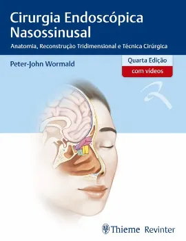 Imagem de Cirurgia Endoscópica Nasossinusal - Anatomia, Reconstrução Tridimensional e Técnica Cirúrgica