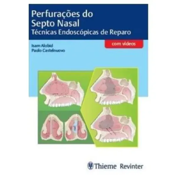 Imagem de Perfurações do Septo Nasal