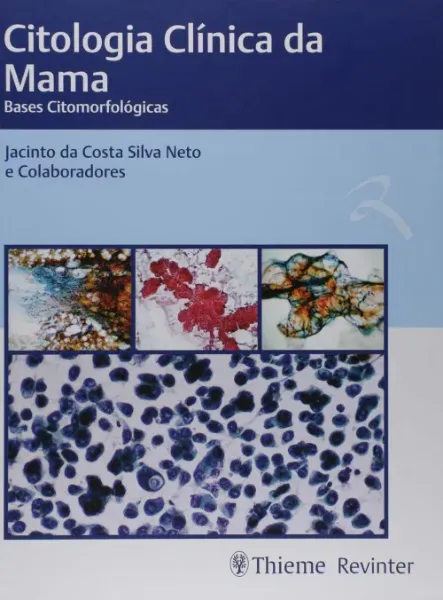Imagem de Citologia Clínica da Mama