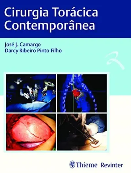 Imagem de Cirurgia Toracica Contemporânea