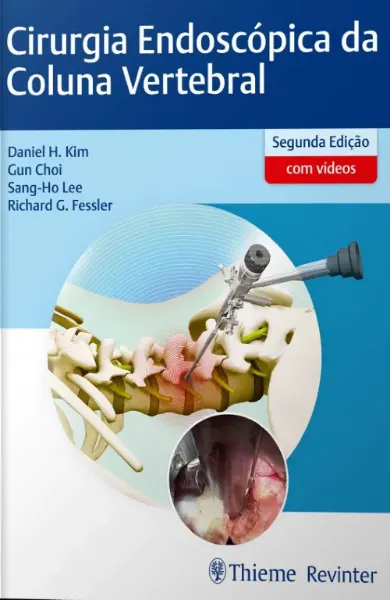 Imagem de Cirurgia Endoscópica da Coluna Vertebral