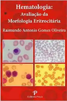 Picture of Book Hematologia: Avaliação da Morfologia Eritrocitária (Pranchas)