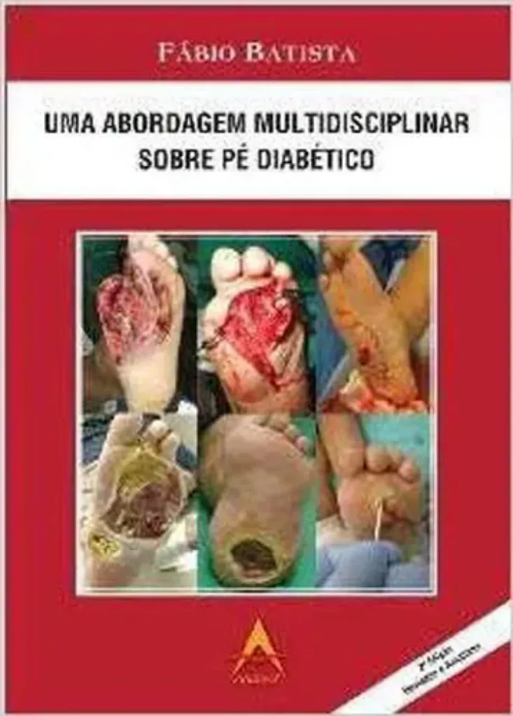Imagem de Uma Abordagem Multidisciplinar sobre Pé Diabético