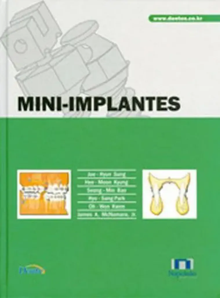 Imagem de Mini-Implantes