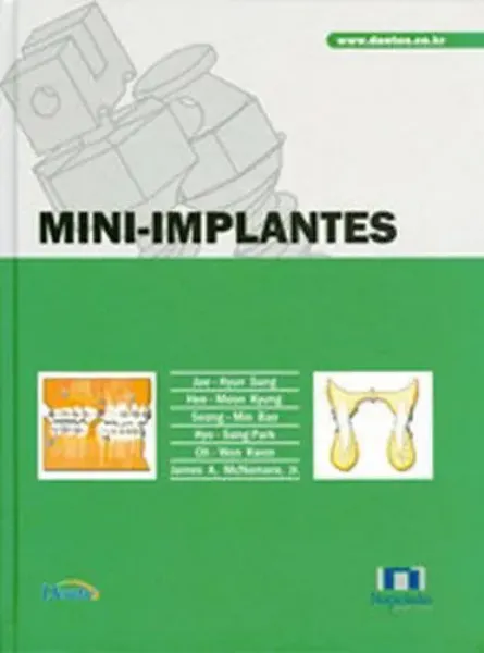 Imagem de Mini-Implantes
