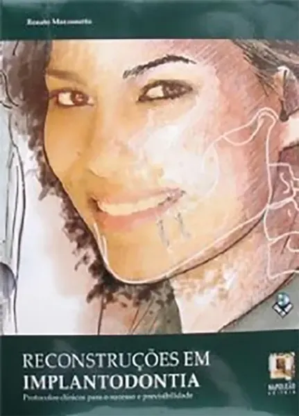 Imagem de Reconstruções em Implantodontia