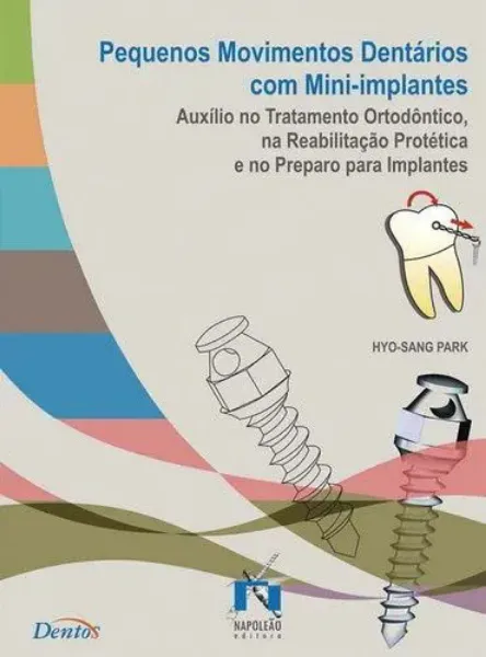 Imagem de Pequenos Movimentos Dentários com Mini-Implantes