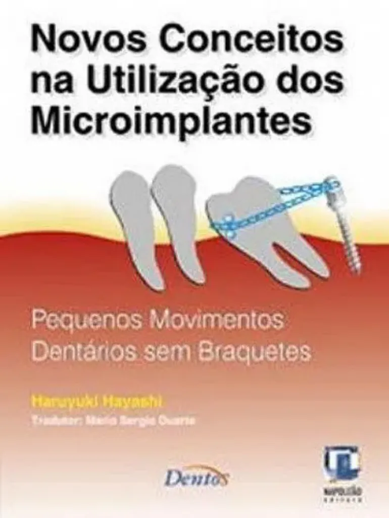 Imagem de Novos Conceitos na Utilização dos Microimplantes - Pequenos Movimentos Dentários sem Braquetes