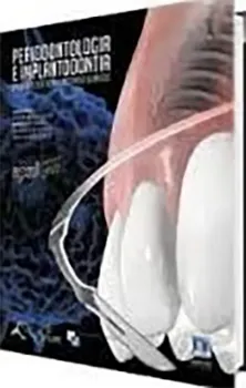 Imagem de Periodontologia e Implantodontia - Soluções Estéticas e Recursos Clínicos