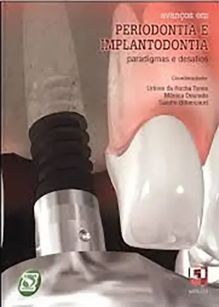 Imagem de Avanços em Periodontia e Implantodontia - Paradigmas e Desafios