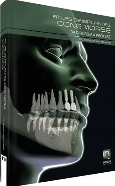 Imagem de Atlas de Implantes Cone Morse - Da Cirurgia à Prótese