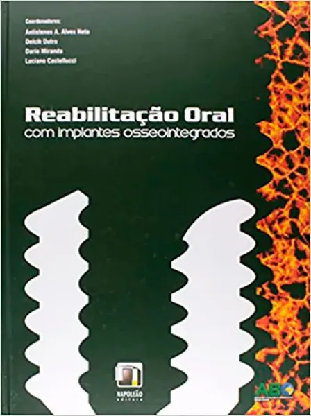 Imagem de Reabilitação Oral com Implantes Osseointegrados