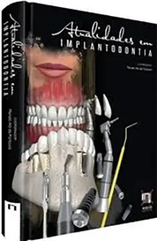 Imagem de Atualidades em Implantodontia