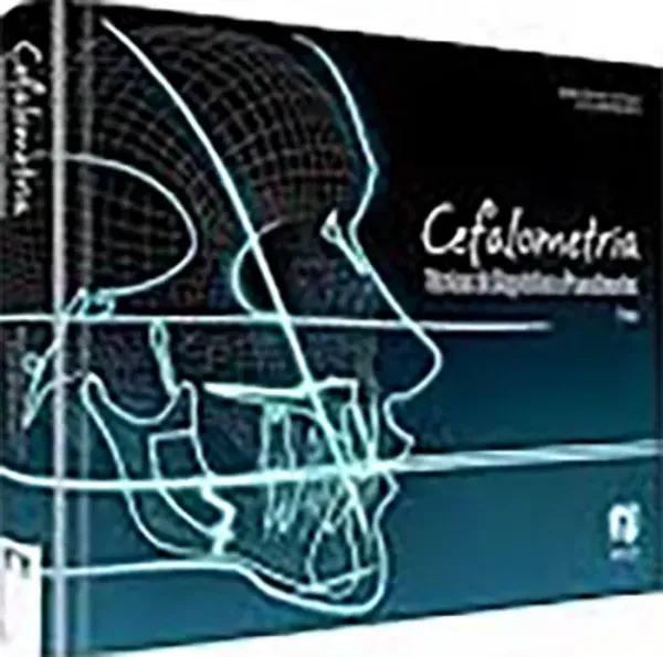 Imagem de Cefalometria - Técnicas de Diagnóstico e Procedimentos