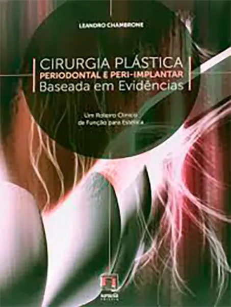 Imagem de Cirurgia Plástica - Periodontal e Peri-Implantar - Baseada em evidências
