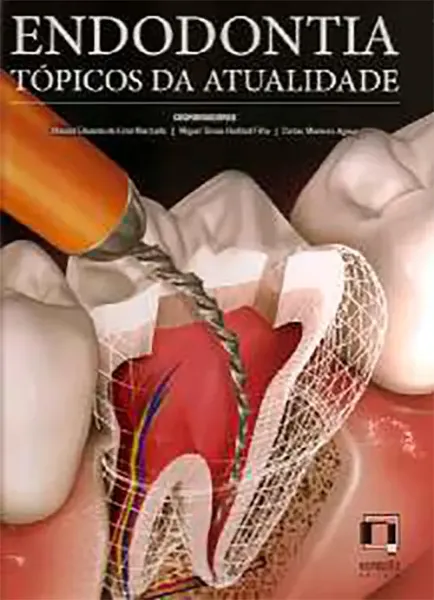 Imagem de Endodontia - Tópicos da Atualidade