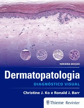 Imagem de Dermatopatologia - Diagnóstico Visual