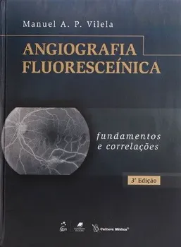 Imagem de Angiografia Fluoresceínica - Fundamentos e Correlações