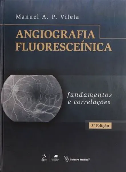 Imagem de Angiografia Fluoresceínica - Fundamentos e Correlações
