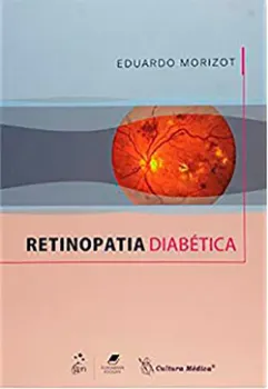 Picture of Book Retinopatia Diabética
