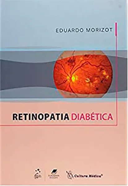 Imagem de Retinopatia Diabética